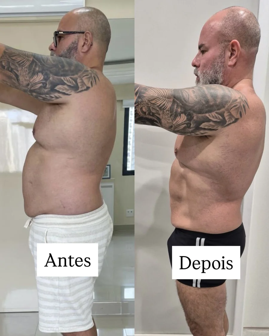 Depoimento 1 - antes e depois